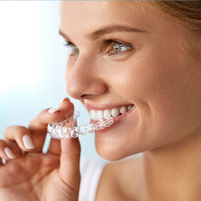 Invisalign